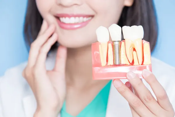 オールオン4とは